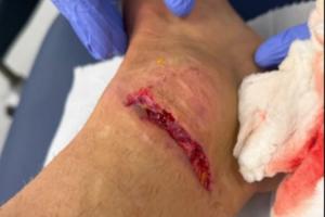 慎入！迪涅腳踝被踩而裁判無表示，換下后怒踢座椅找四官泰勒理論